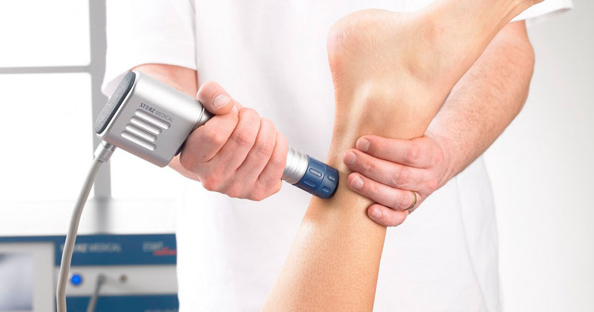 Onde D’Urto Radiali -